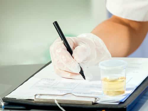 Test de detección de drogas en la Orina